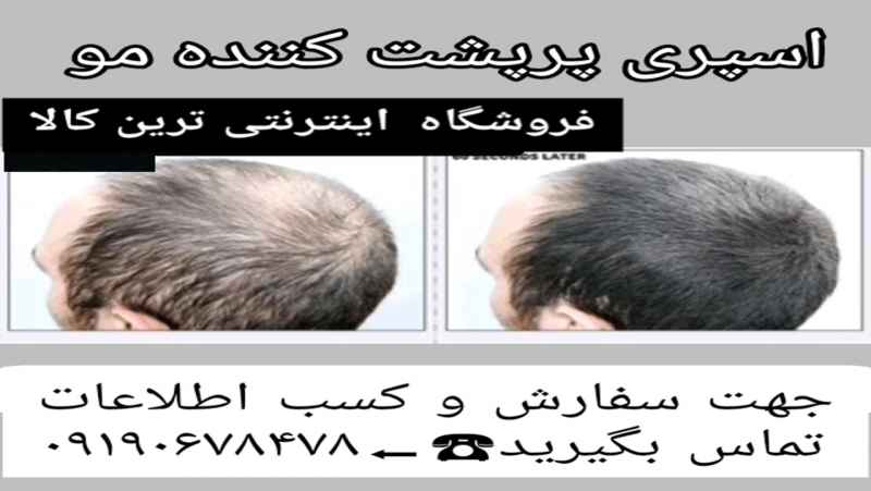 اسپری پرپشت کننده موی سر09190678478- اسپری پرپشت کننده موی سر زدکا