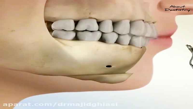 مشکلات فک و دندان-دکترمجیدقیاسی-دندانپزشک زیبایی مشهد