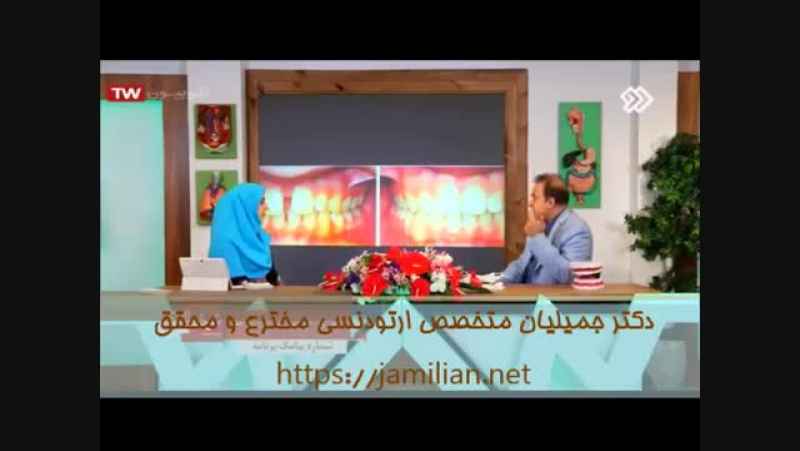 فاصله بین دندان و دندان نیش با درمان ارتودنسی / متخصص ارتودنسی / دکتر جمیلیان