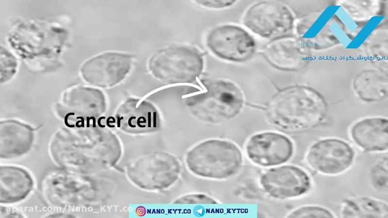 نانوذرات طلا چگونه سلول سرطانی را منفجر می کند؟ (شرکت نانو کاوشگران یکتای توس)